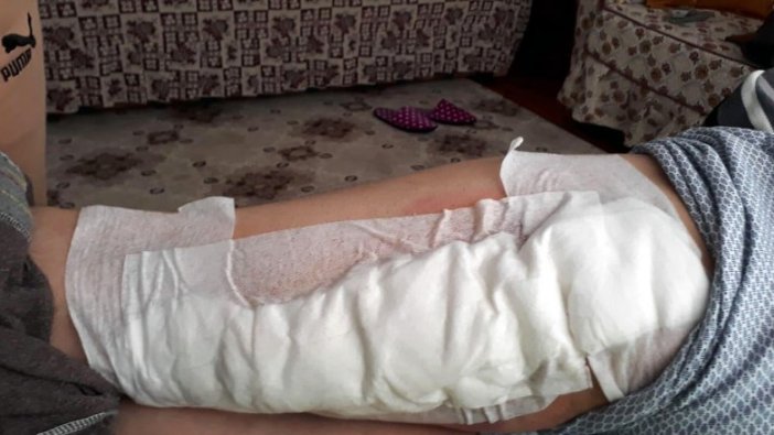 Yaban domuzu saldıran çiftçinin bacağına 60 dikiş atıldı