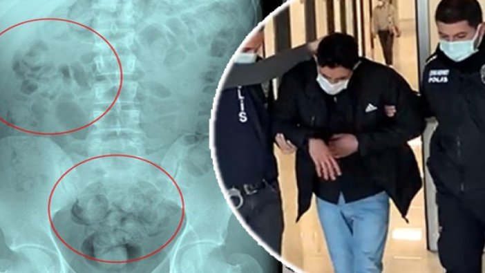 Otogarda rahatsızlanan İranlının midesinde 890 gram uyuşturucu çıktı