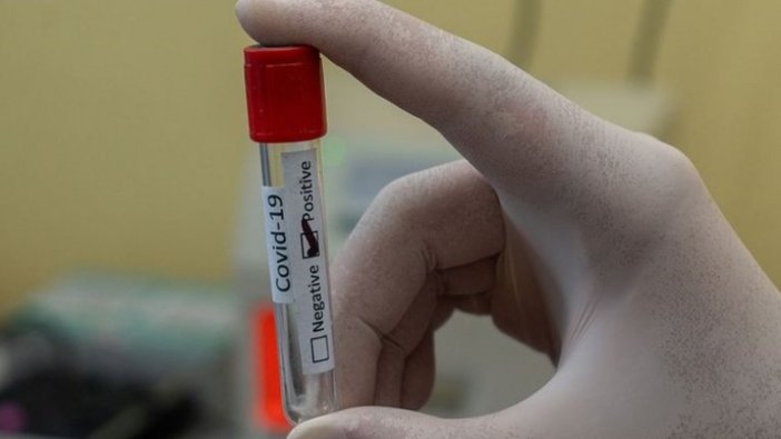 Araştırma: Kovid-19’u hafif atlatan 10 kişiden 1’inde hastalığın etkisi uzun sürüyor