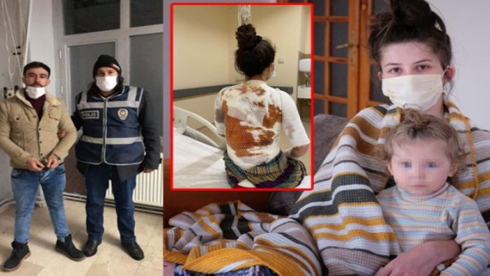 Eşiyle 1,5 yaşındaki kızını kaynar suyla haşlayan sanığa iyi hal indirimli 3 yıl 9 ay hapis