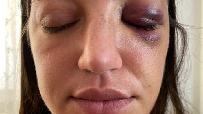 Mankene eski sevgili dehşeti