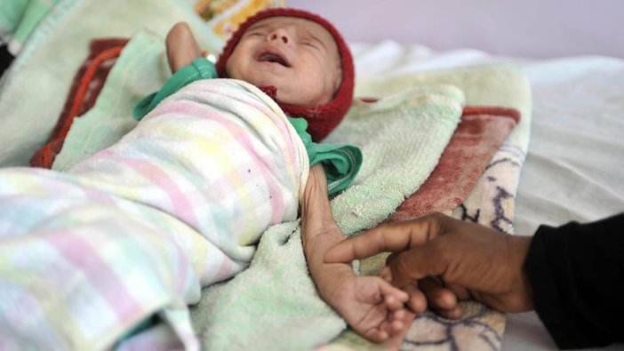 Yemen'deki açlık intihara sürüklüyor