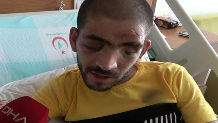 Geçirdiği kaza sonucu dünyası karardı