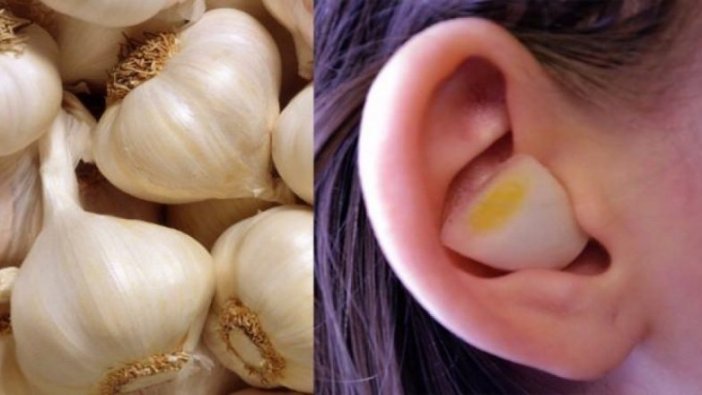 Sarımsak'ın şaşırtan faydası