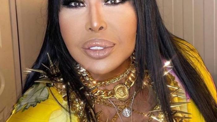 Bülent Ersoy verdiği konserde yüzündeki değişimle dikkat çekti