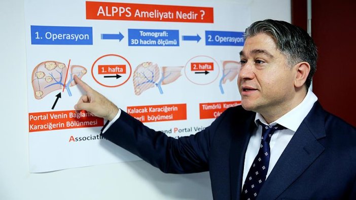 Karaciğer kanseri hastalarına yeni yöntem umut oldu