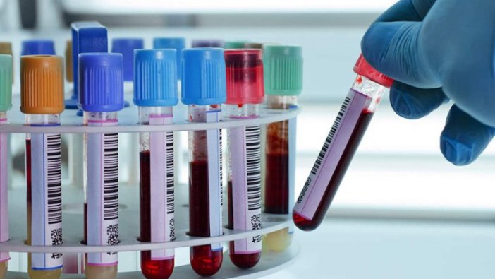 İstanbul Üniversitesi kan verme seti satın alacak