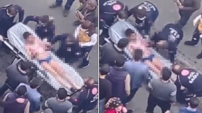 Vücudunun yüzde 40'ı yandı; sağlık durumu kritik