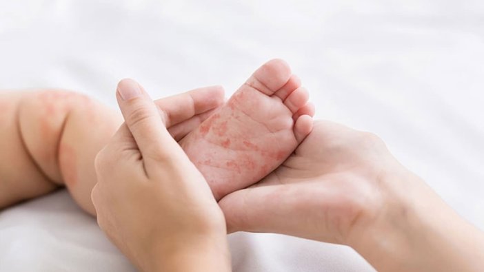 DSÖ uyardı! Milyonlarca çocuk tehlike altında