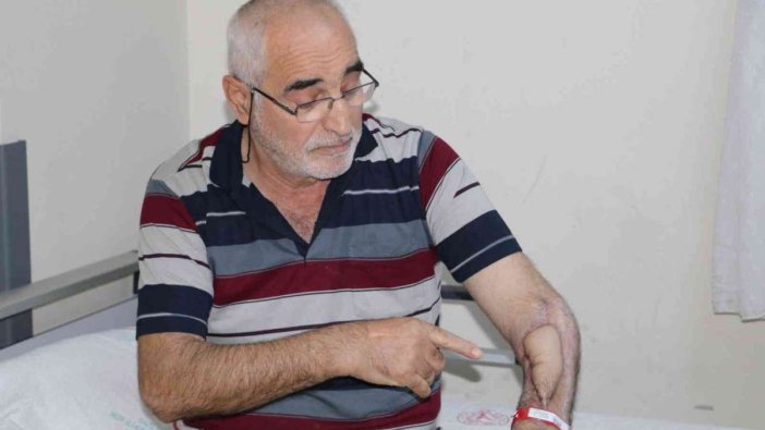 Çüreyen kolu doku nakli ile nasıl kurtarıldı