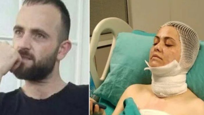 Boşandığı kadına kimyasal madde ile saldırdı