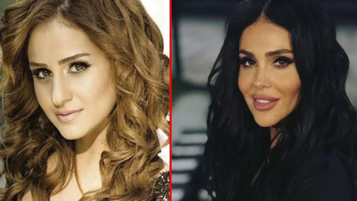 Azerbaycanlı şarkıcı Günel Zeynalova estetikli haliyle sosyal medyanın diline düştü