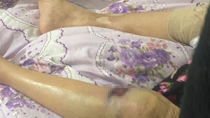 Bakıcının darp ettiği yaşlı kadın ölüm kalım savaşı veriyor