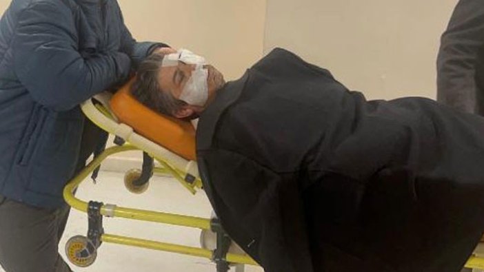 Sivas Ziraat Odası genel sekreterine saldırı