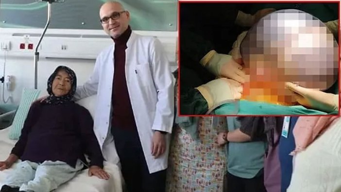 Karın ağrısı çekiyordu: 89 yaşındaki kadının karnından çıkanlar herkesi şoke etti!