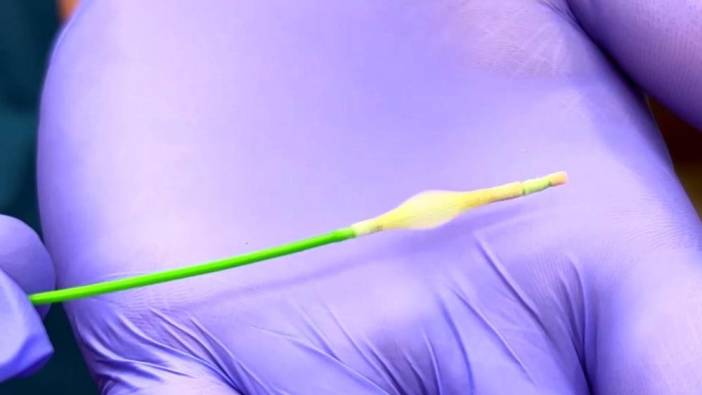 KOAH hastalarını koşturan tedavi!