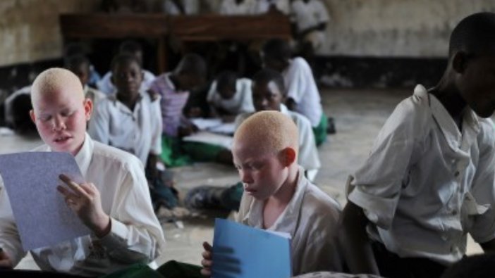 Albino adamın cesedi korunaklı mezardan çalındı