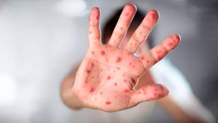 Uzmandan kritik uyarı: O ilde artış görülüyor