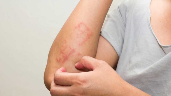 Uzman isimden geçmeyen yaralara ilişkin kritik uyarı