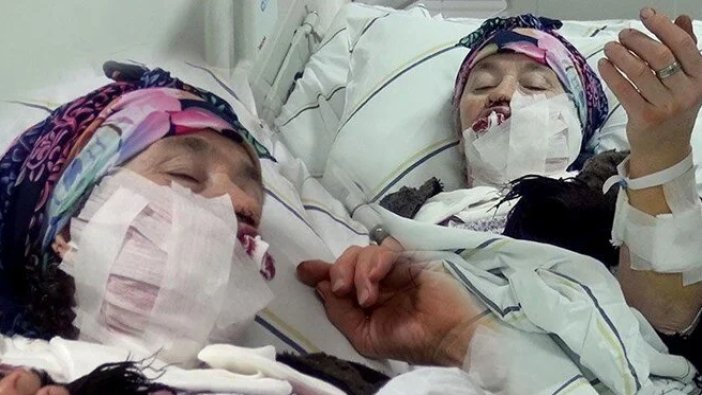 Erzurum'da kuduz vakası