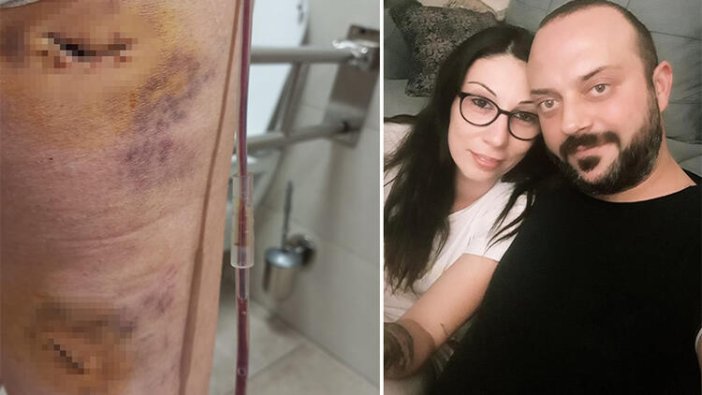 Eşini 6 yerinden bıçakladı