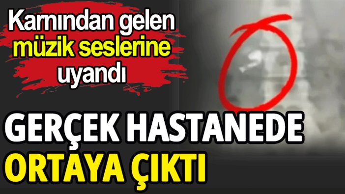 Karnından gelen müzik seslerine uyandı