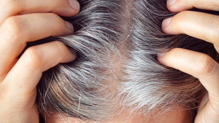 Uzmanlar kritik sonucu paylaştı: Saç beyazlaması tarihe mi karışıyor?