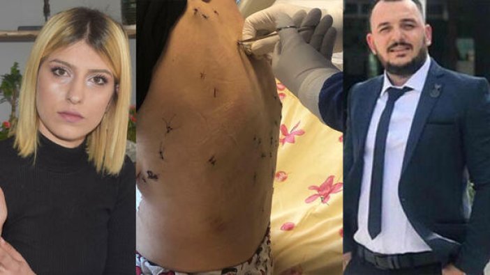 Barışmak istemeyince 38 yerinden bıçakladı