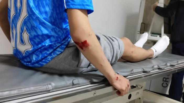 Köpeklerin saldırdığı lise öğrencisi yaralandı