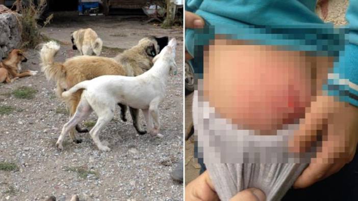 Başıboş sokak köpeği, 10 yaşındaki çocuğa saldırdı