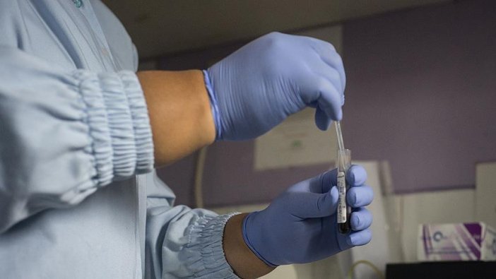 Hindistan'da AIDS krizi