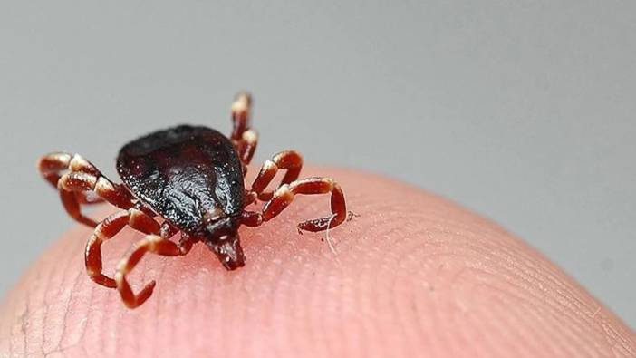 Sivas'ta KKKA hastalığı şüphesiyle tedavi gören kişi hayatını kaybetti