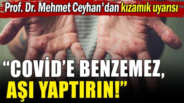 Prof. Dr. Mehmet Ceyhan'dan kızamık uyarısı: Covid'e benzemez, tek yol aşılama