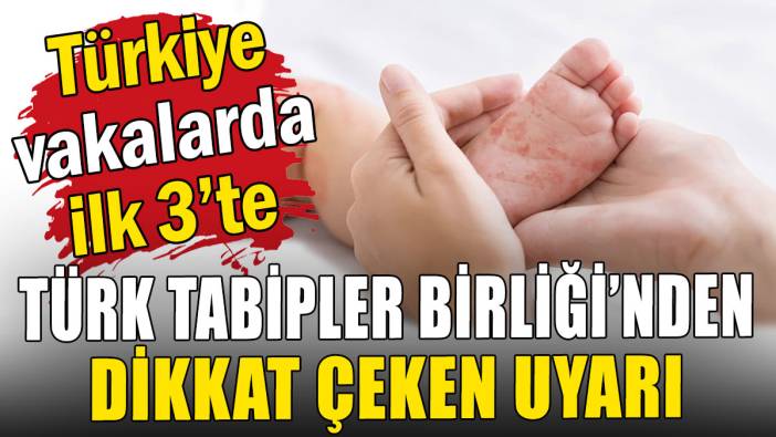 Türk Tabipler Birliği'nden dikkat çeken uyarı