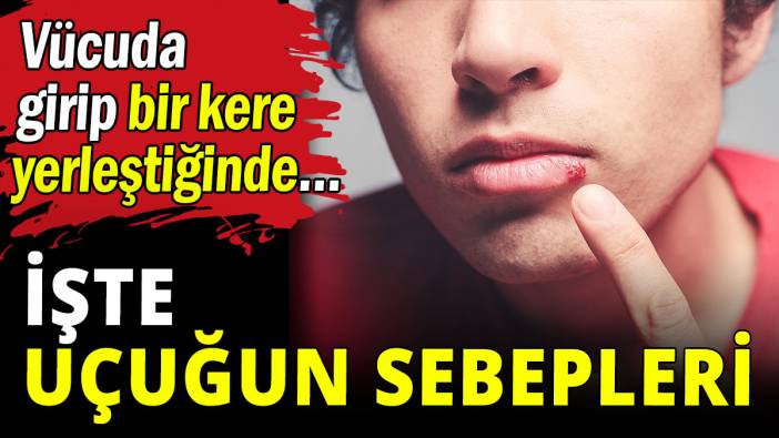 İşte uçuğun sebepleri