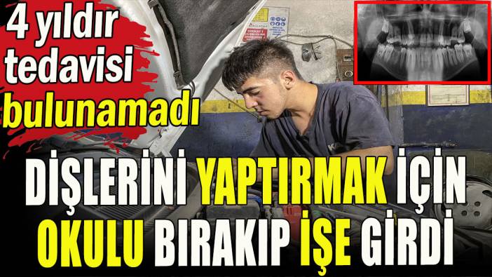 Dişlerini yaptırmak için okulu bırakıp işe girdi