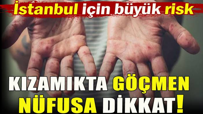 Kızamıkta göçmen nüfusa dikkat!