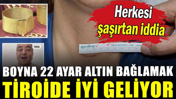 Herkesi şaşırtan iddia: Boyna 22 ayar altın bağlamak tiroid rahatsızlığına fayda sağlıyor