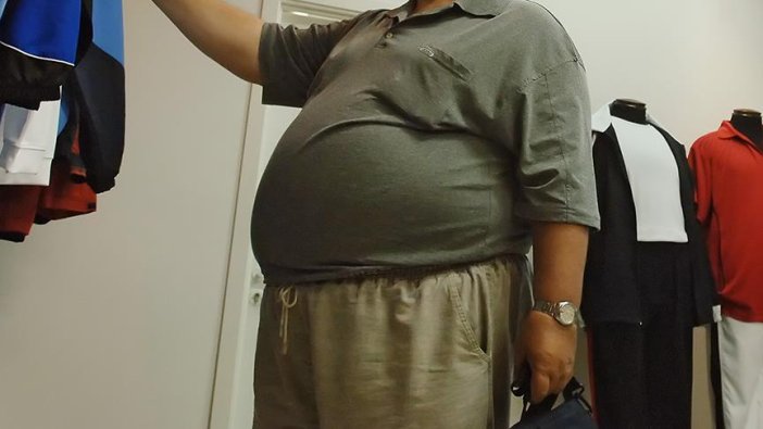 Bel bölgesindeki yağlanma D vitamini eksikliğinin habercisi