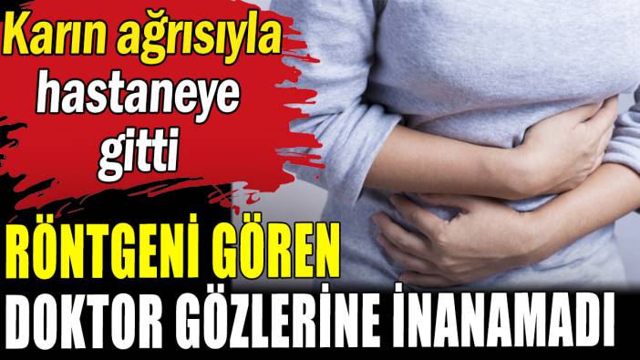 Karın ağrısıyla hastaneye gitti: Doktor gözlerine inanamadı