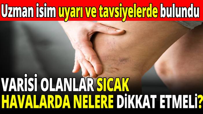 Varisi olanlar sıcak havalarda nelere dikkat etmeli? Uzman isim uyarı ve tavsiyelerde bulundu