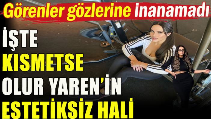 Kısmetse Olur Yaren'in estetiksiz halini görenler gözlerine inanamadı