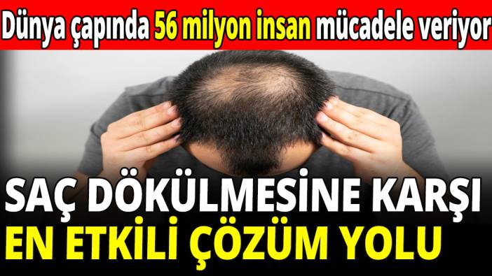 Saç dökülmesine karşı en etkili çözüm yolu!