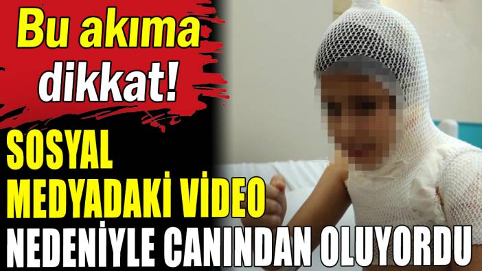 Sosyal medyadaki akımı deneyen küçük kız canından oluyordu