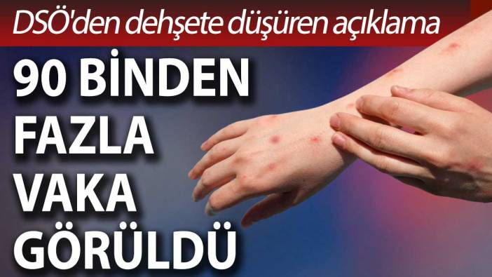 DSÖ'den dehşete düşüren açıklama: 90 binden fazla vaka görüldü