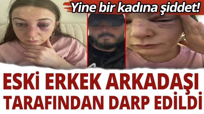 Yine bir kadına şiddet! Eski erkek arkadaşı tarafından darp edildi