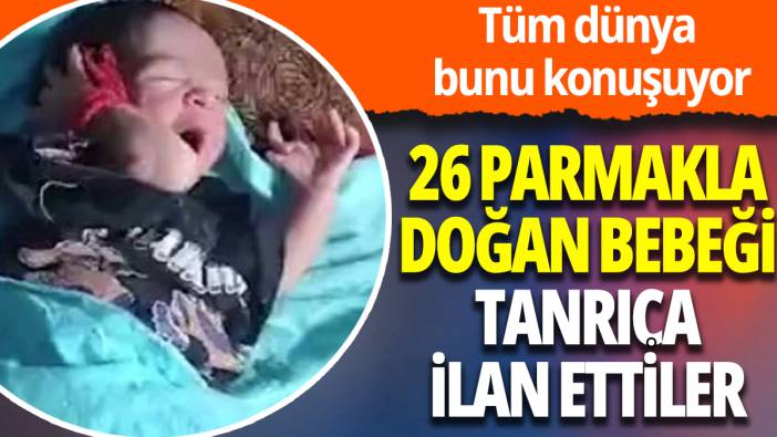 Dünya bu olayı konuşuyor: 26 parmakla doğan bebeği tanrıça ilan ettiler