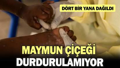 Maymun çiçeği durdurulamıyor! Dört bir yana dağıldı