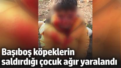 Başıboş köpeklerin saldırdığı çocuk ağır yaralandı