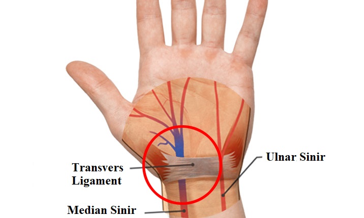 karpal-tunel-sendromu-nedir-belirtileri-ve-evreleri-nelerdir.jpg